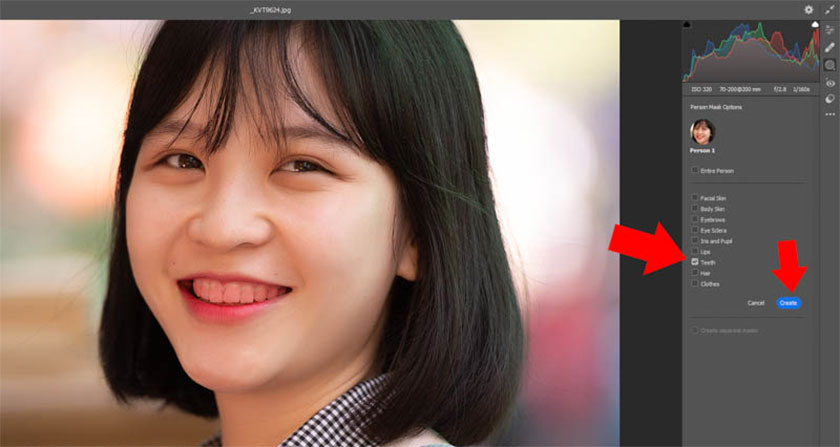 đánh dấu vào Teeth