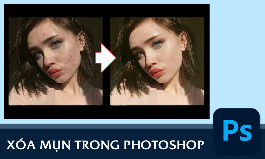 Xóa mụn trong photoshop