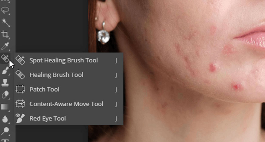 Chọn Spot Healing Brush Tool hoặc bạn có thể nhấn phím tắt là J