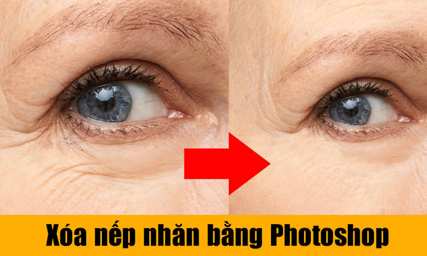 xóa nếp nhăn bằng Photoshop