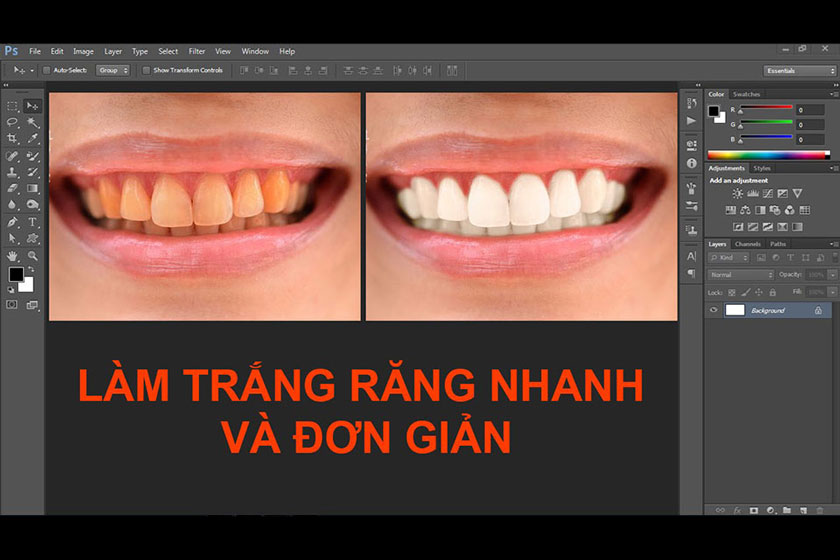 làm trắng răng photoshop